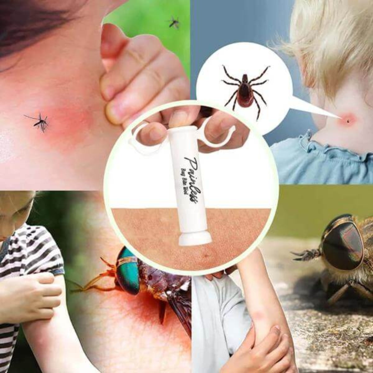 Mosquito Bite Extractor providing relief from mosquito bites, bee stings, and other insect bites; shown being used on irritated skin.